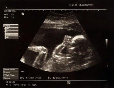 fotolia_1862031_xs