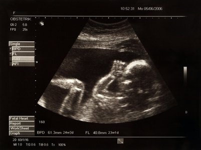 Le foetus sensible au stress…