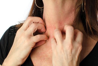 Woman scratching her arm