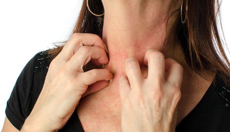 Le stress amplifie le risque d’allergies
